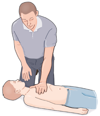 A Technique de massage cardiaque externe chez le grand enfant