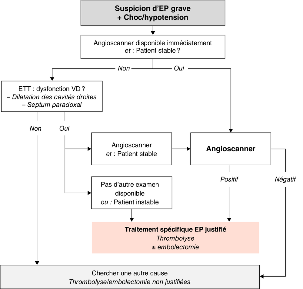 A Stratégie diagnostique devant une suspicion d’EP grave avec signes de choc/hypotension artérielle (d’après les recommandations européennes)