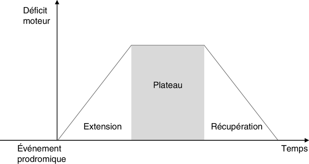 A Les trois phases évolutives caractéristiques d’un syndrome de Guillain-Barré