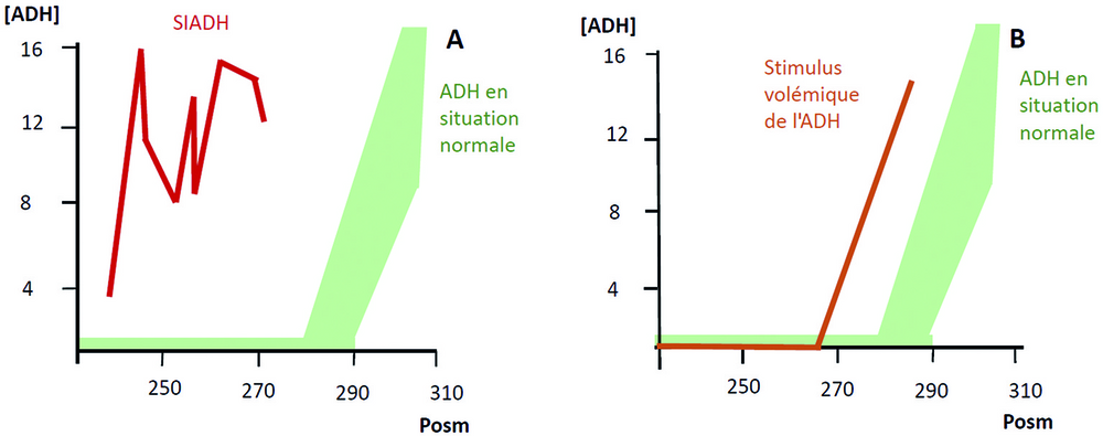 B Sécrétion d’ADH malgré une hyponatrémie