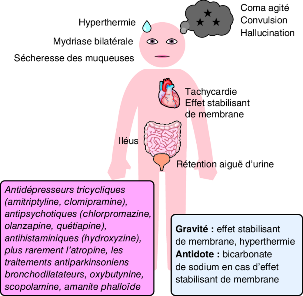 A Toxidrome anticholinergique ou atropinique