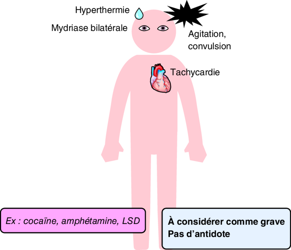 B Toxidrome adrénergique/sympathomimétique