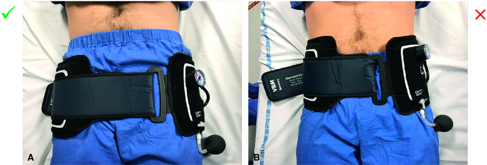 A Ceinture de contention pelvienne